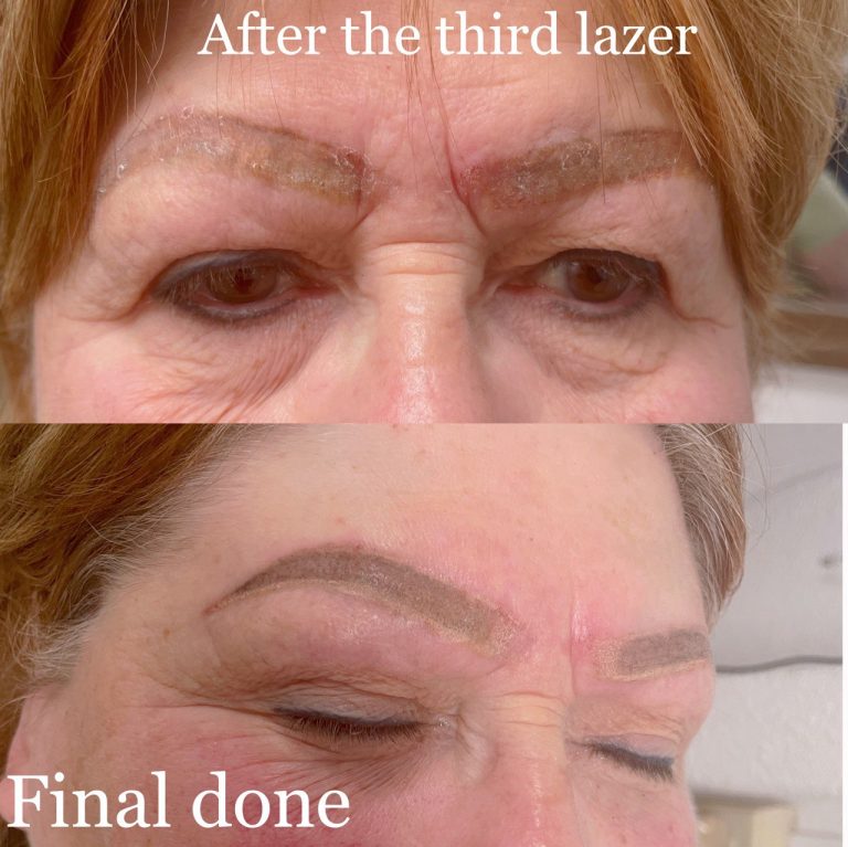 Fixing eyebrows2