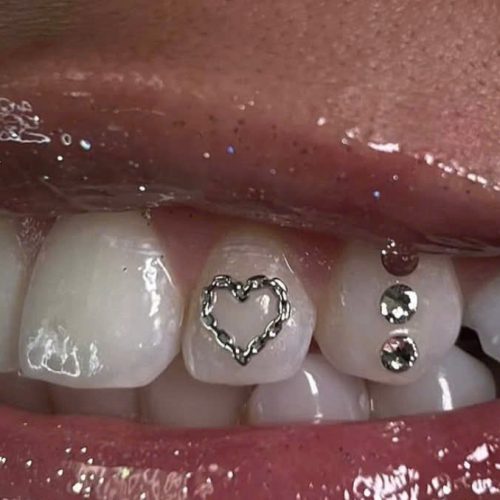 Teeth Whitening Teeth Whitening