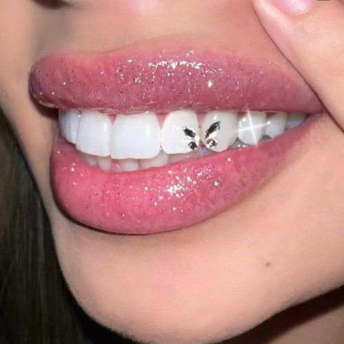 Tooth Gems Tooth Gems